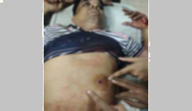 বিএনপি নেতাকে লক্ষ্য করে গুলি, সহযোগীর বুকে বিদ্ধ