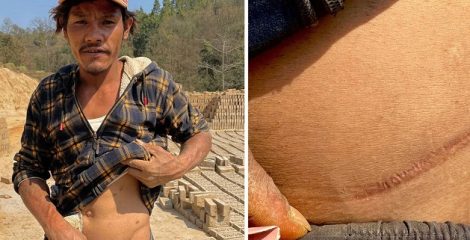 কিডনি আবার গজাবে, দালালের এমন কথায় গ্রামটির নাম ‘কিডনি ভ্যালি’